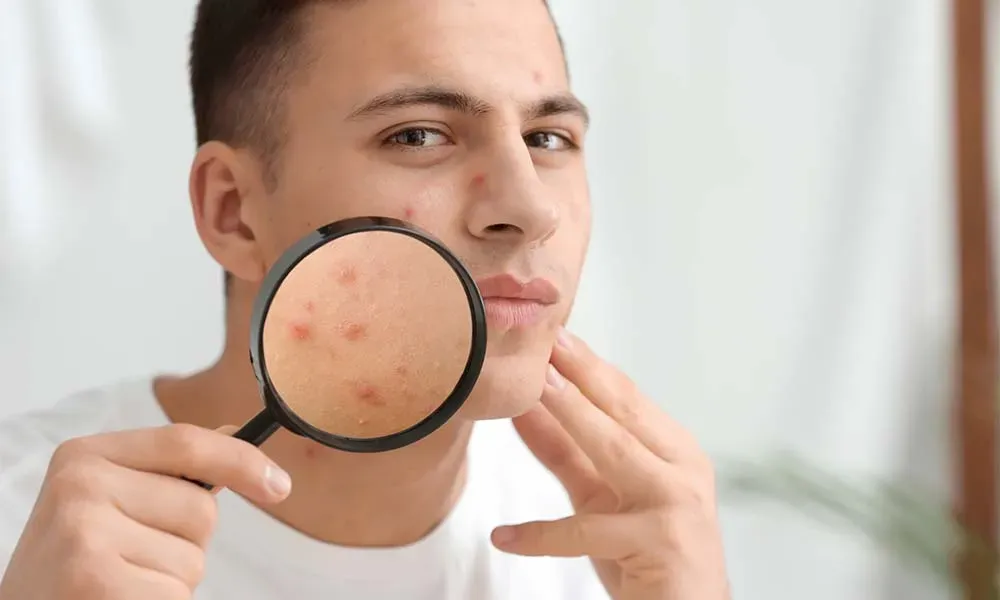 A Dermatologist’s Guide To Skin Care During Pregnancy chemical peels Cypress