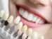 cosmetic dentistry