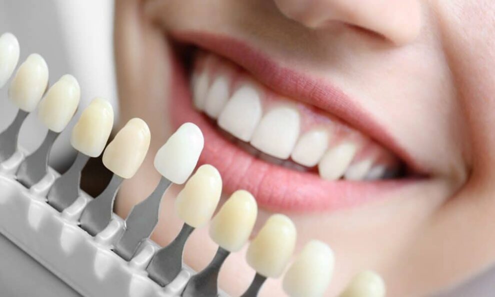 cosmetic dentistry